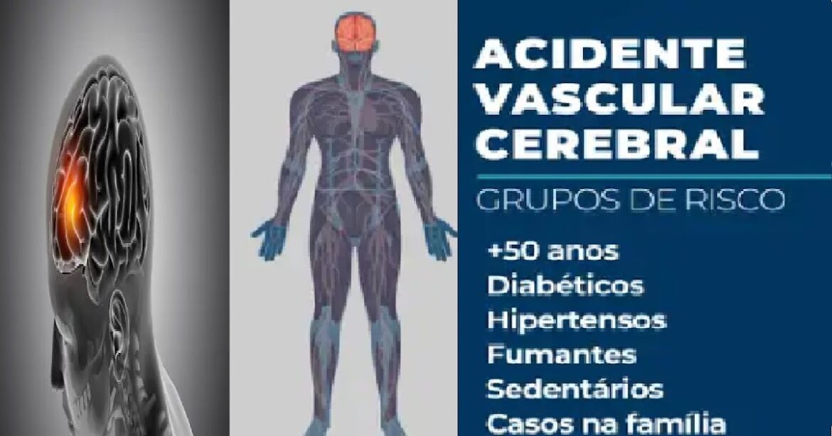 AVC mata uma pessoa a cada seis minutos no Brasil