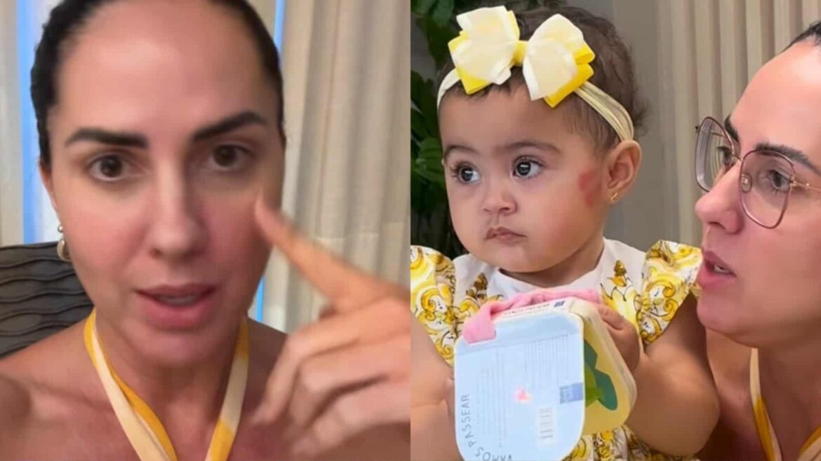 Graciele Lacerda explica mancha no rosto da filha