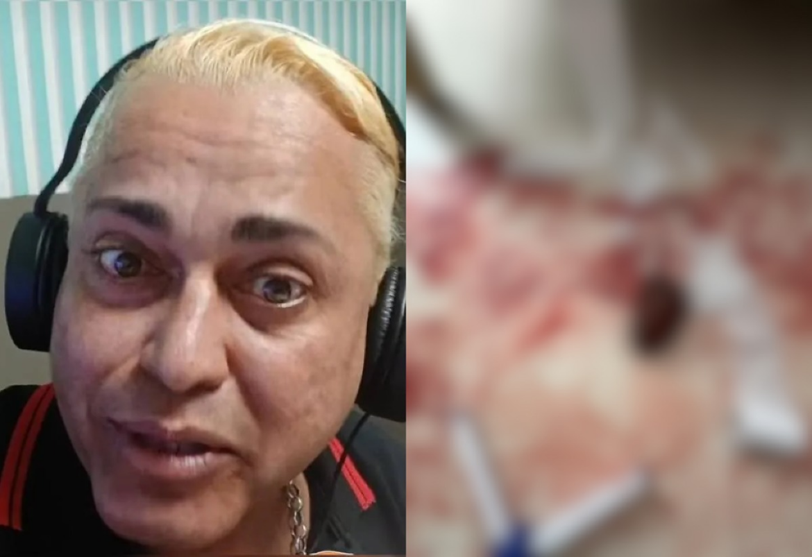 Namorado que agrediu radialista com pedradas na cabeça após noite de farra é preso | G5News