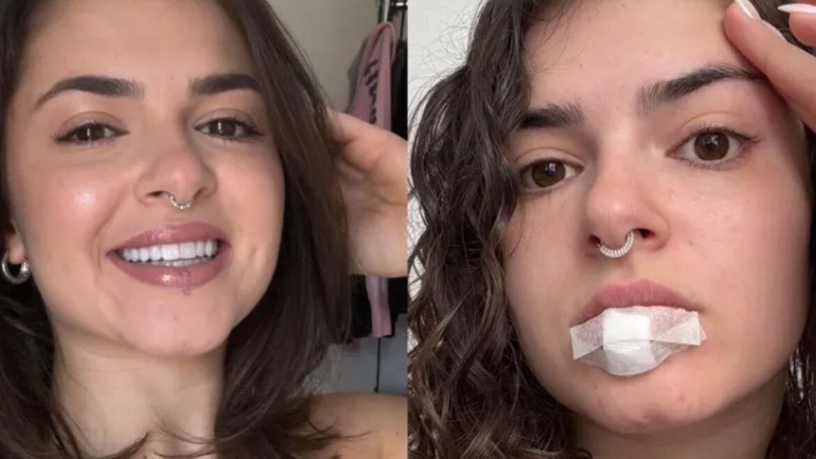 Miss Bumbum Kerolay Chaves - Reprodução/Redes sociais