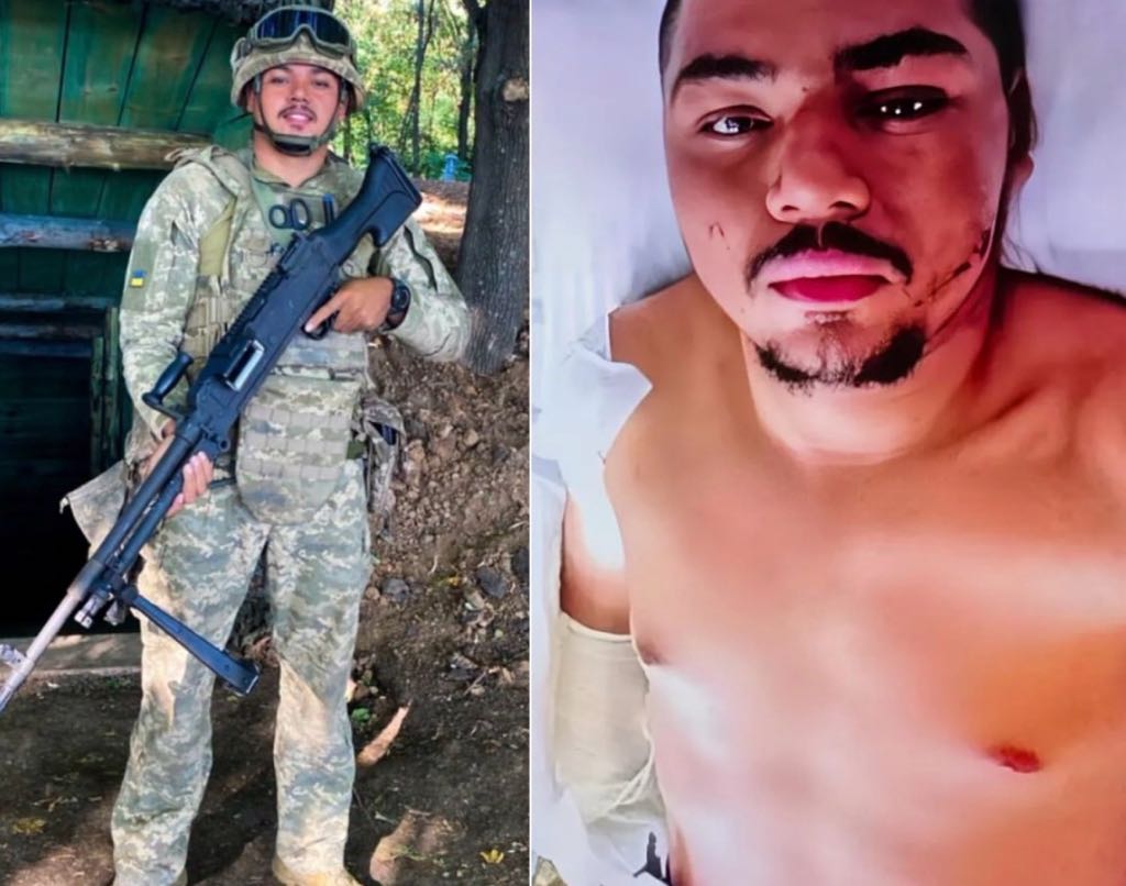 MAIS UM! Maranhense perde parte do braço em combate na guerra entre Rússia e Ucrânia